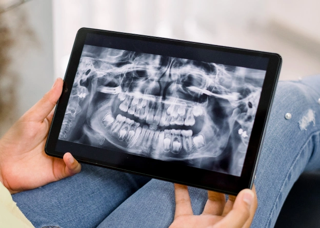 ai-assisted-radiographic-analysis-with-overjet