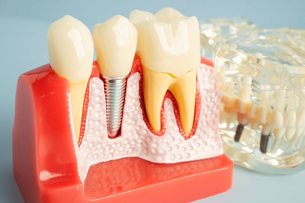 dental implant healing & recovery guide
