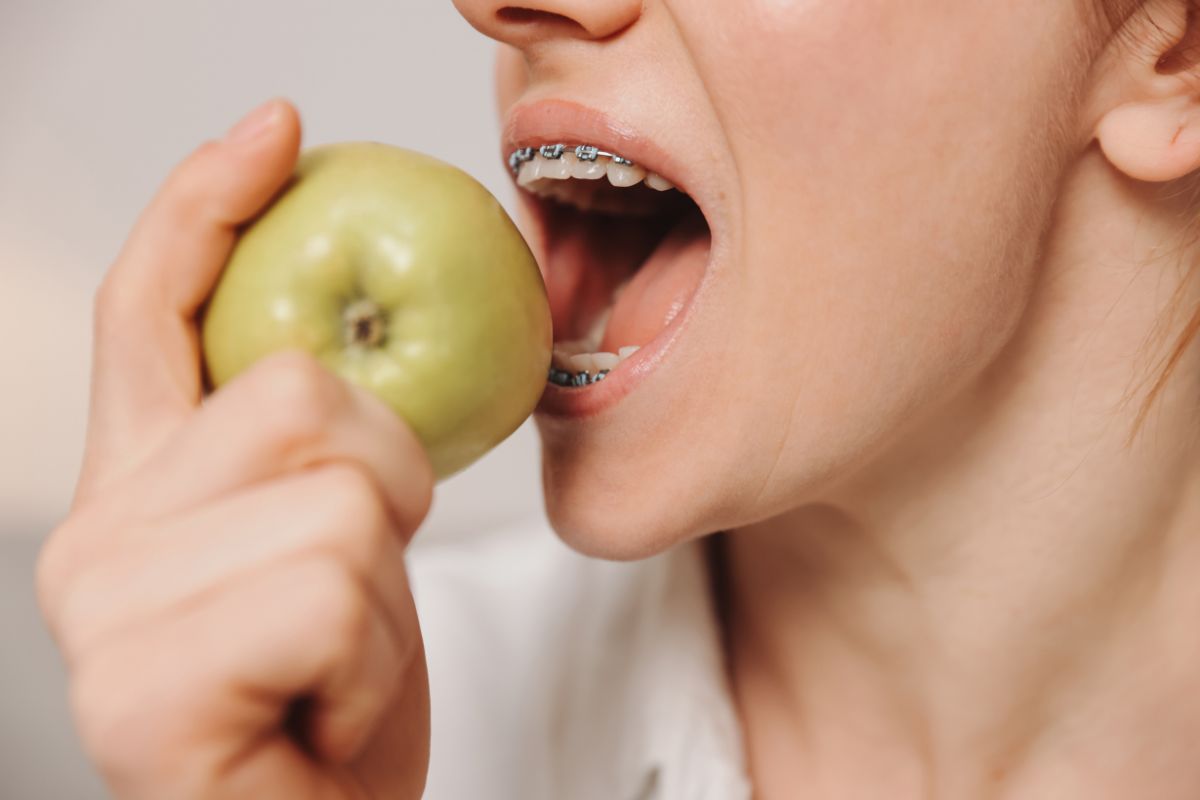 best foods to after teeth whitening
